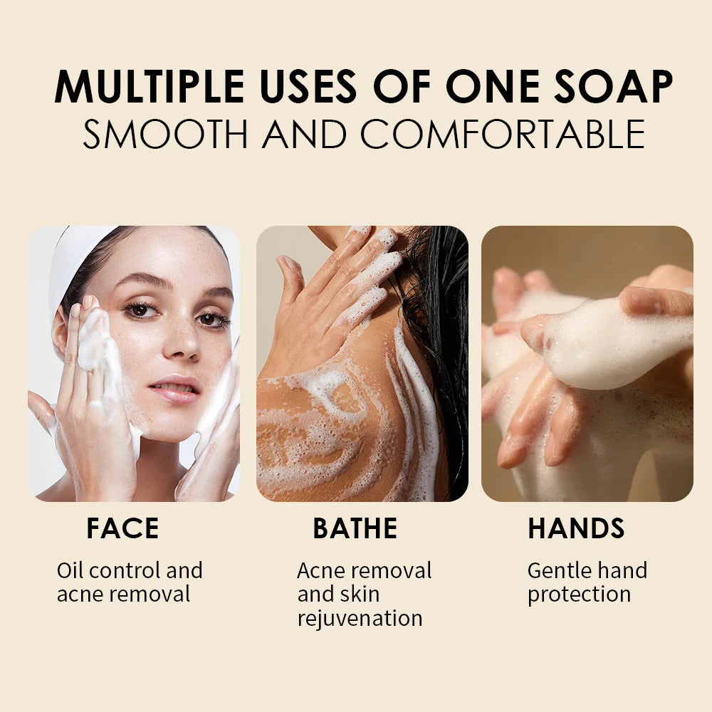 🧼5 Pack of Naturally Magic™ - Turmeric Kojic Soap 100g – Natural Vitamin C Formula | Deep Cleansing, Brightening & Moisturizing Face & Body Bar